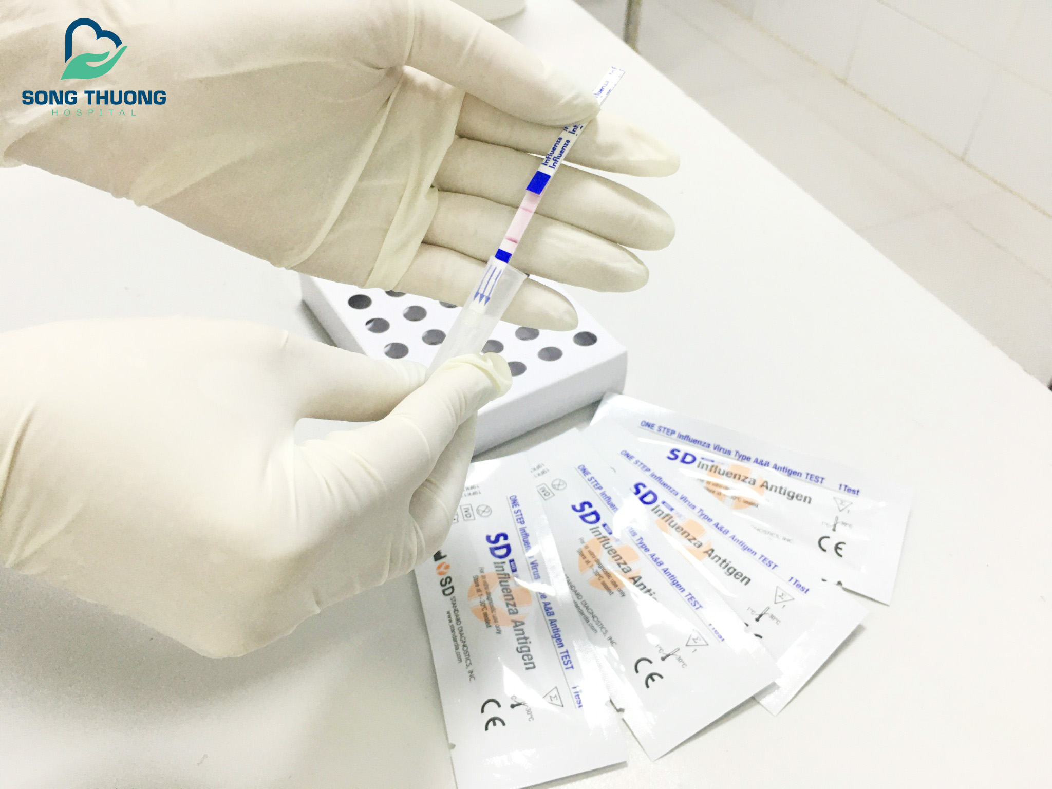 Triển khai xét nghiệm Influenza virus A/B test nhanh chẩn đoán bệnh cúm